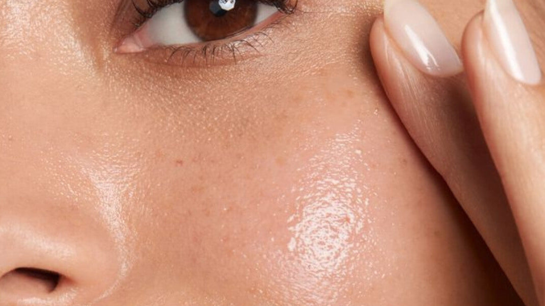 Face Club | How to Understand and Manage your Oily Skin