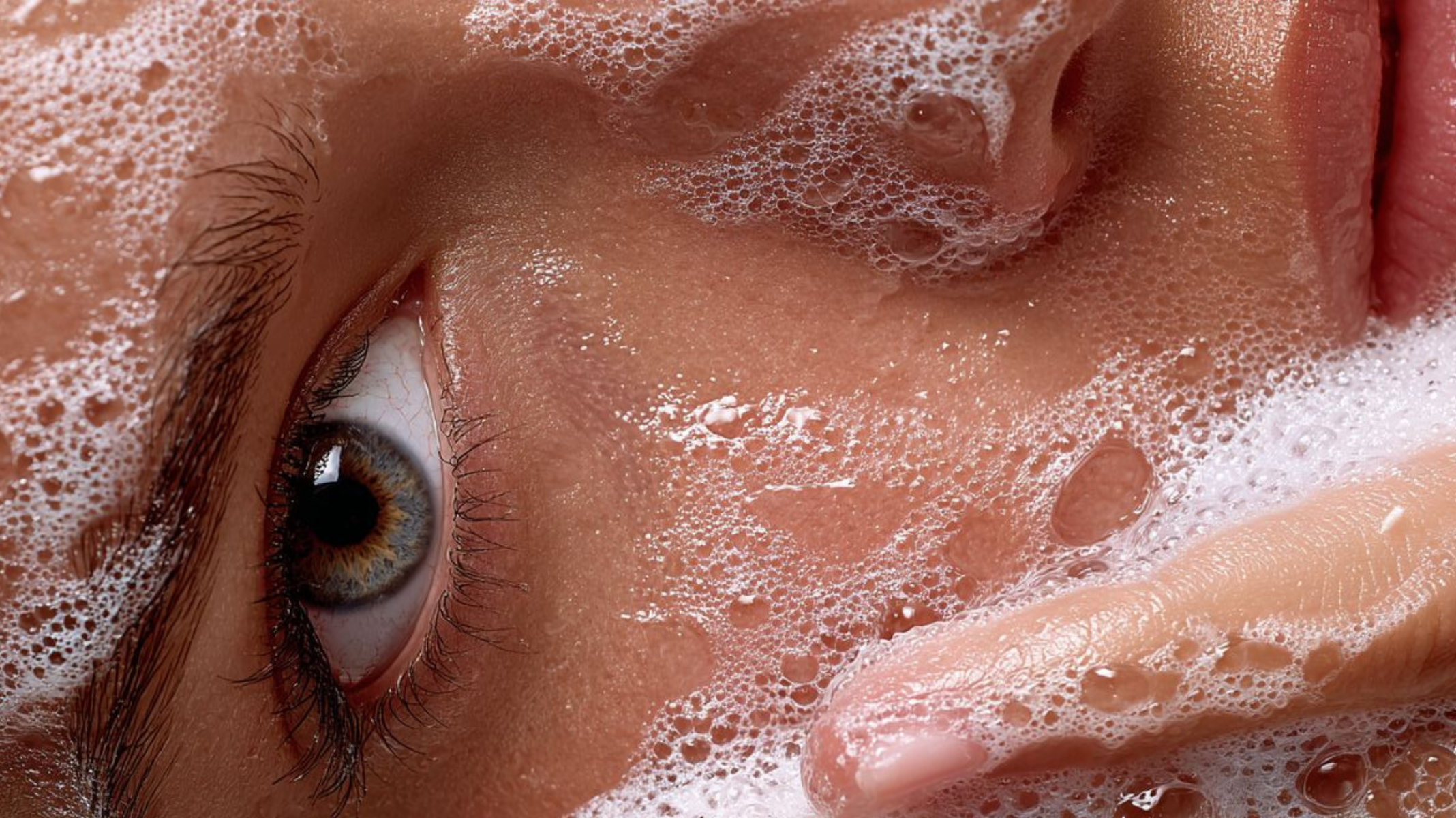 Why Adult Acne Is So Hard to Clear (and Why Most Routines Make It Worse)