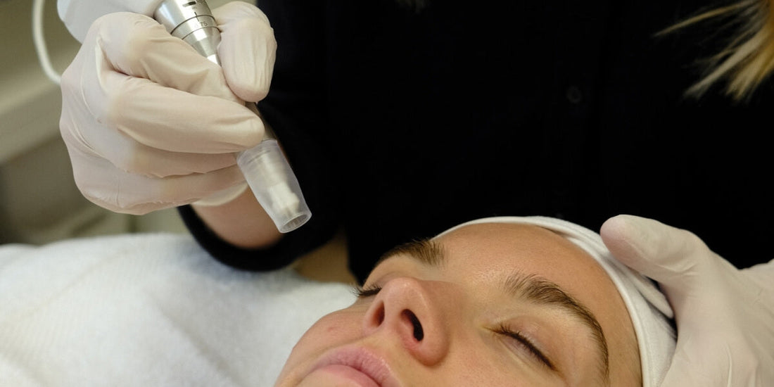 Microneedling: Everything You Need to Know About This Transformative Facial Treatment