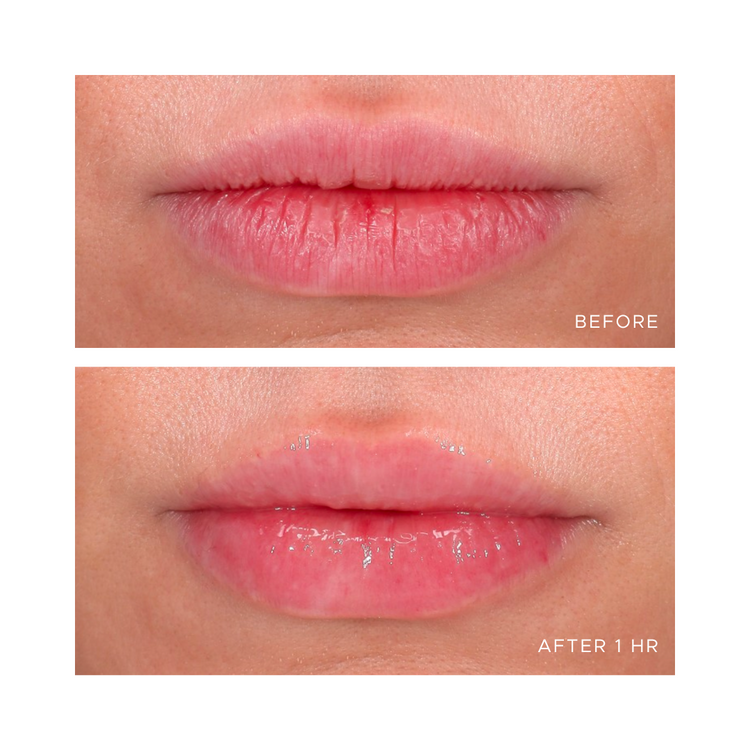 Ân-Gloss Ceramide Lip Treatment