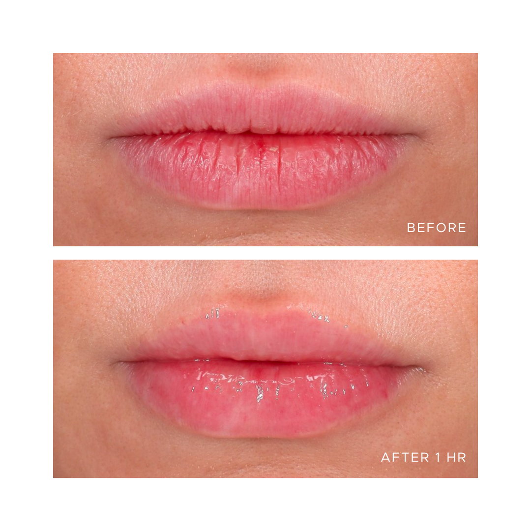 Anfisa Skin Canada Ân-Gloss Ceramide Lip Tint – Sheer Buildable Color & Intense Hydration in Berry Crumble | Face Club