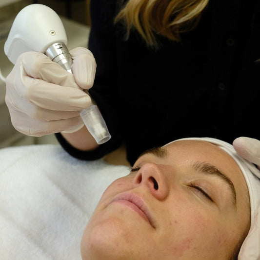 The Collagen Builder Microneedling – Advanced Skin Rejuvenation for Acne Scars, Wrinkles, and Hyperpigmentation with LED Therapy | Face Club