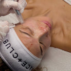 The Collagen Builder is a minimally invasive skin rejuvenation treatment designed to boost collagen production and enhance youthful skin. 
This facial uses Microneedling, or Collagen Induction Therapy, which stimulates your own wound repair response to form healthy collagen and elastin. - Best Microneedling Facial | Best Facial Studio Greater Vancouver | Best Facial Treatment Vancouver | Best Facial Massage Vancouver | Skin Care Centre Vancouver | Best Facial Treatment Richmond BC